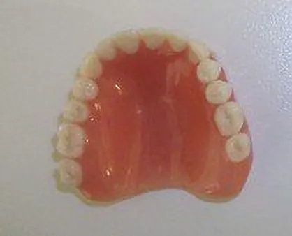 Vollprothese für den Oberkiefer