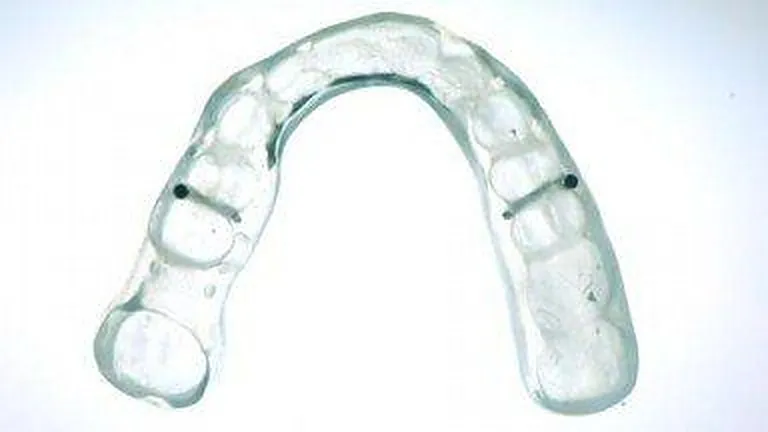 Durchsichtige Aufbissschiene aus Acrylglas
